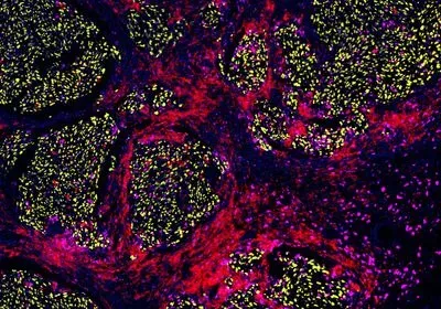 A false-colored micrograph showing swirls of yellow, red, and magenta cells